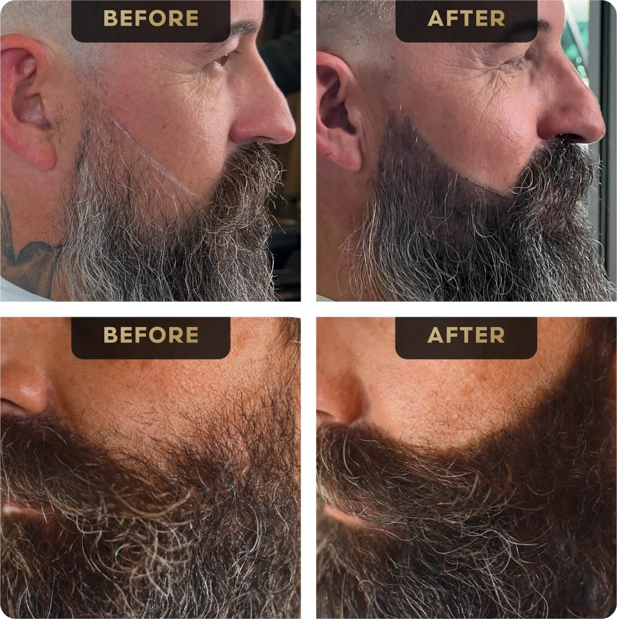 Baldr’s Beard Pen before and after example