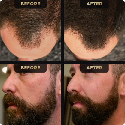 Beard Pen and Hair Concealer Bundle – before and after example