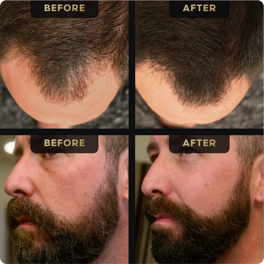 Beard Pen and Hair Concealer Bundle – before and after example